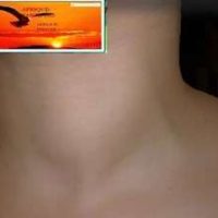 Solution naturelle efficace hyperthyroïdie