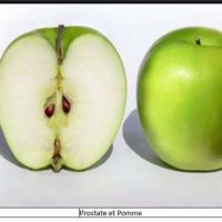 Traitement Naturel Prostatite