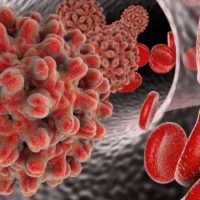 Traitement Naturel Contre Hépatite B