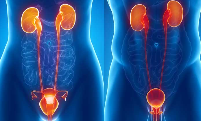 L'urétrite symptômes et traitement naturel