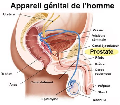 Traitement naturel contre une prostatite