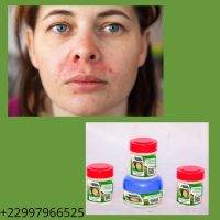 Remède naturel contre l'infection à staphylocoques