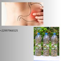 Solution naturelle contre l'ulcère