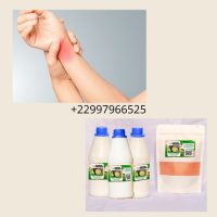 Remède naturel contre le syndrome canal carpien