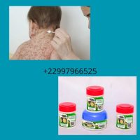 Remède naturel contre la varicelle