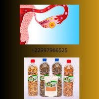 Remède naturel contre l'anovulation