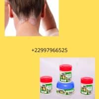 Solution naturelle contre le psoriasis