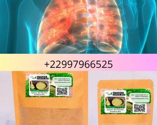 Traitement naturel de la fibrose kystique