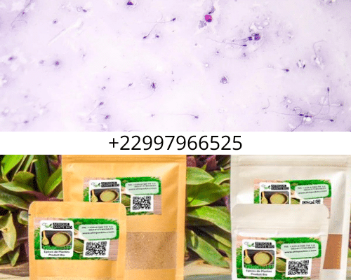 Solution Naturelle de L'Asthénozoospermie