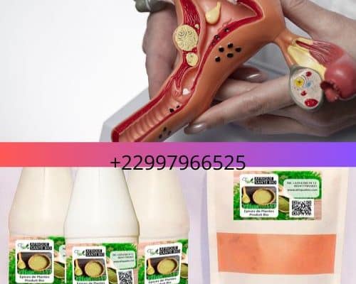 Plante pour soigner les myomes