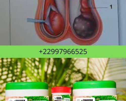 solution naturelle contre l'orchite