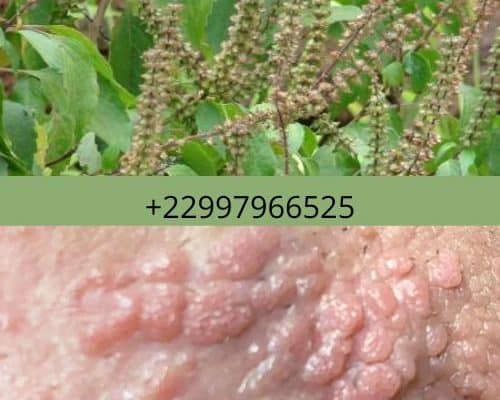 Bienfait d'Ocimum Gratissimum