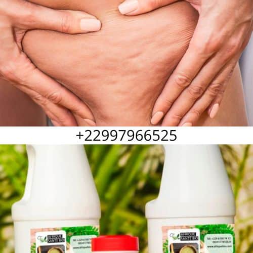 Solution Naturelle Contre La Cellulite