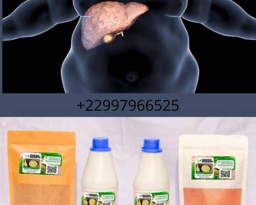 Traitement naturel de la stéatose hépatique